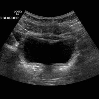 ecografia abdomen inferior lima